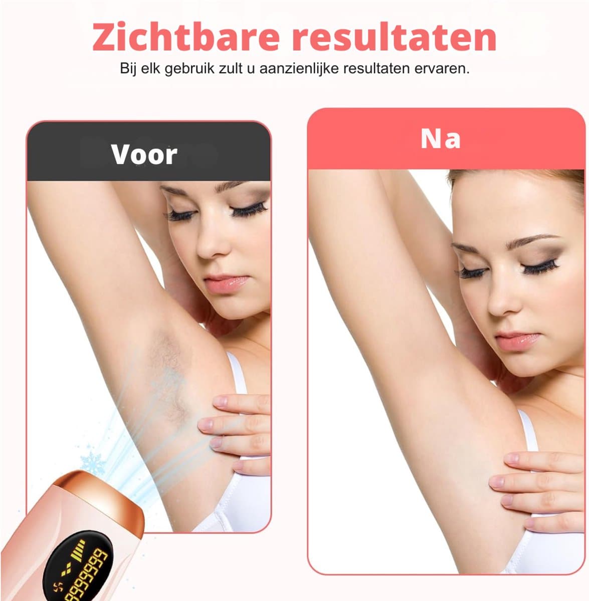 SNJY® Laser Ontharingsapparaat - Epilator - Ontharingsapparaten - IPL Ontharing - 5 Standen - Roze thumbnail 3
