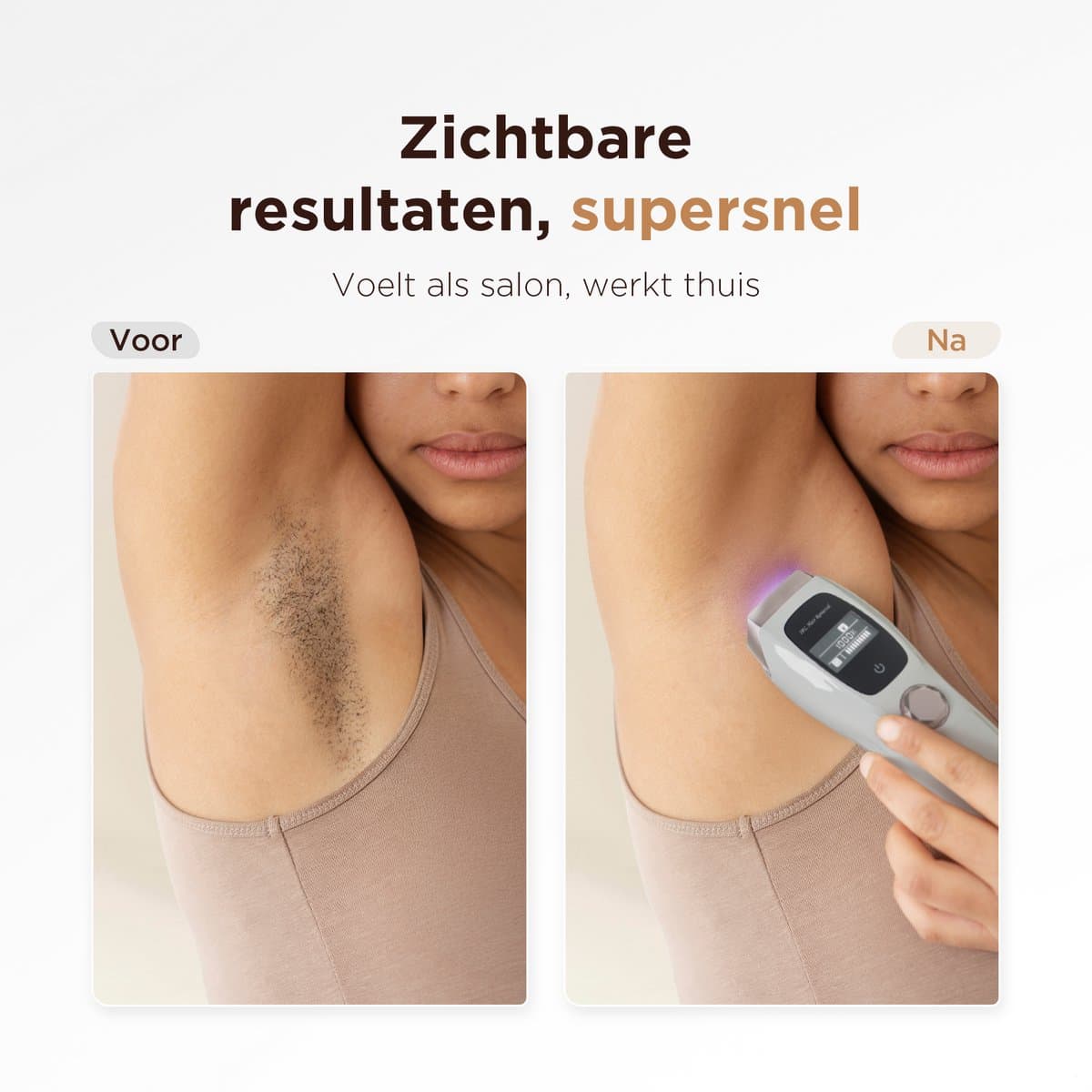 Dsource® IPL Ontharingsapparaat met 1M flitsen, 10 standen thumbnail 6