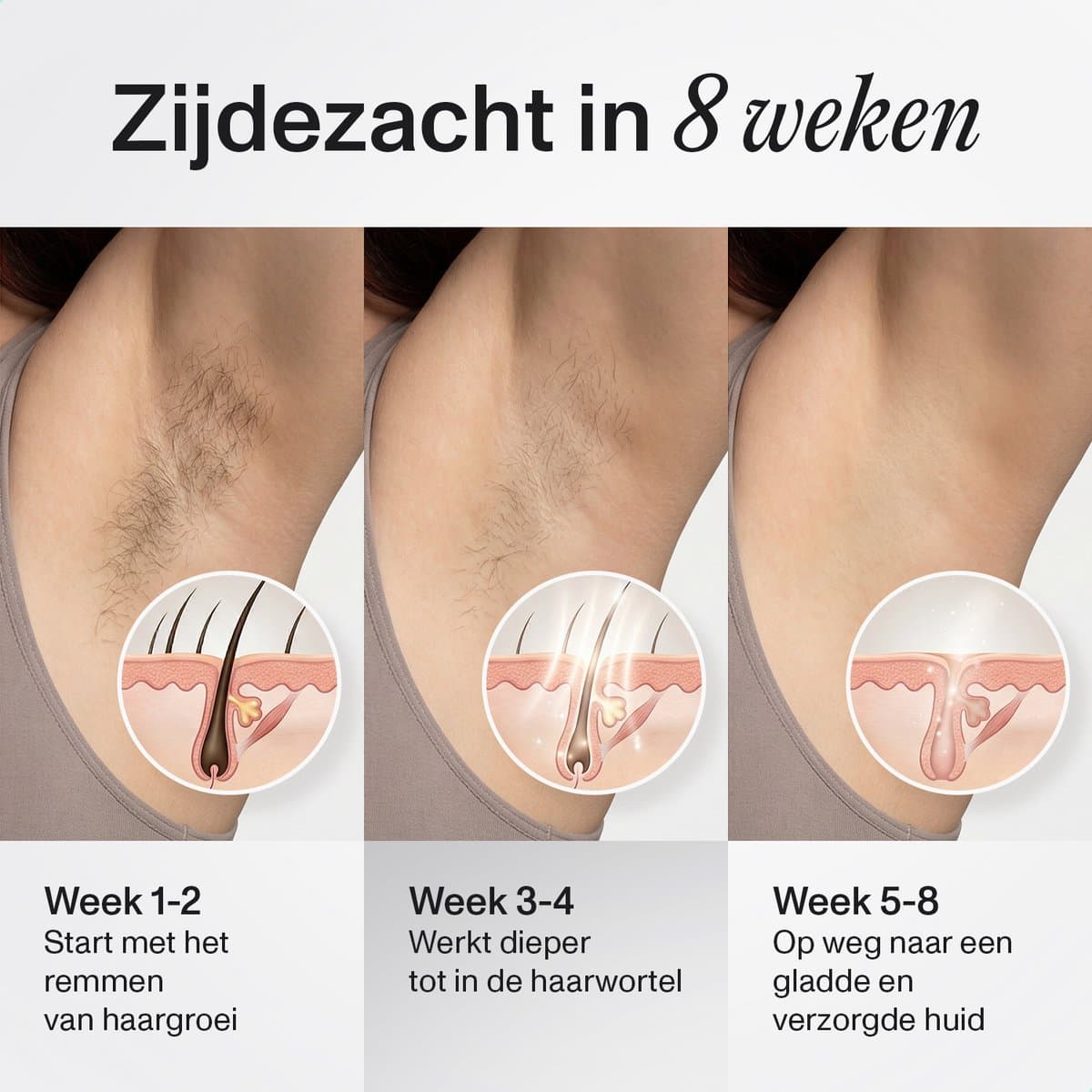 Nawy® IPL Laser Ontharingsapparaat - Laser Ontharing - Pijnloos Ontharen met Ice Cooling - Permanente Ontharing voor alle Lichaamsdelen - voor Mannen en Vrouwen - 999.900 Flitsen - Inclusief Beschermbril en Scheermes - Epileerapparaat Dames thumbnail 3