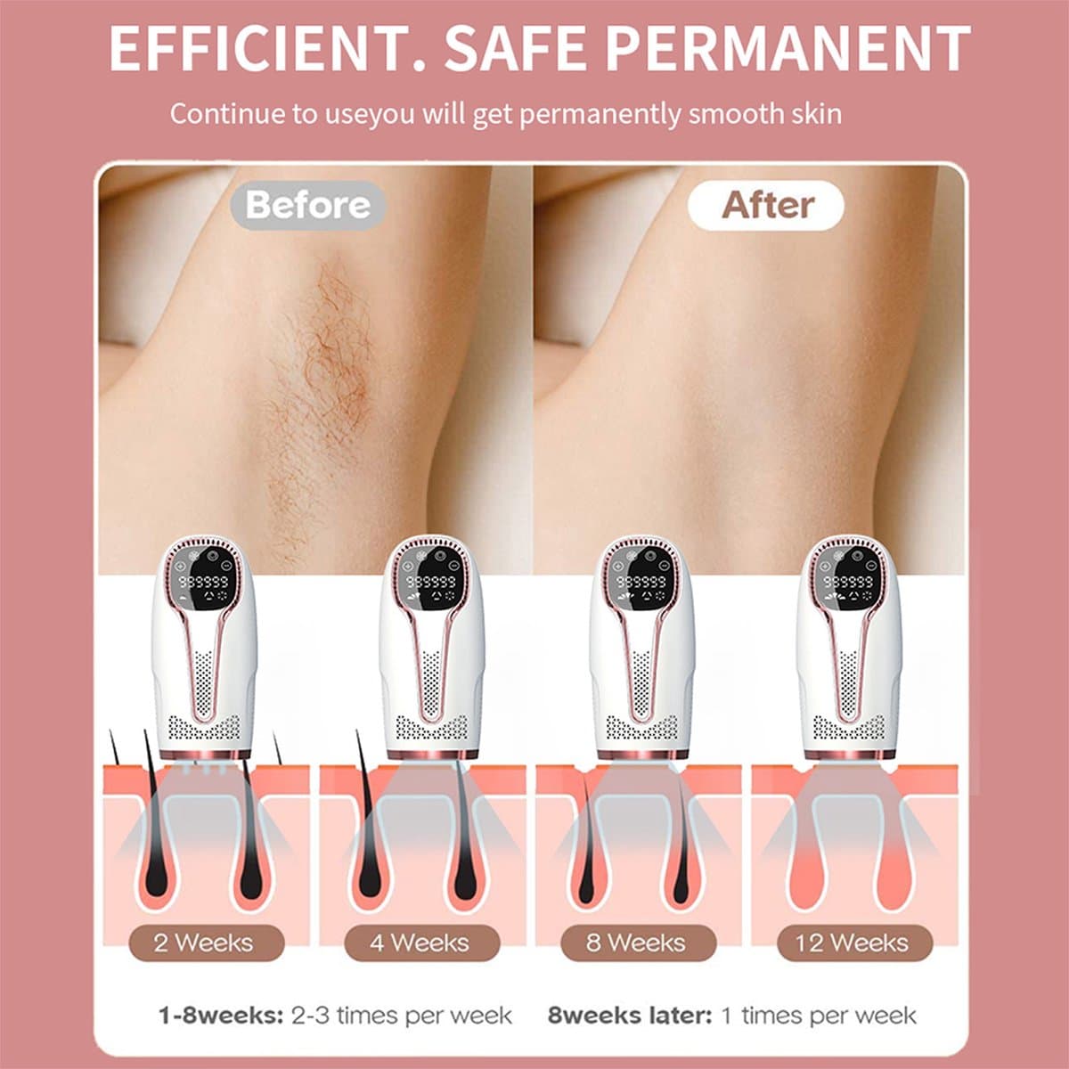 OKWISH IPL Ontharingsapparaten - IPL Ontharingsapparaat - Laser Ontharing Thuis - Pijnloze Ontharing - IJskoel Ontharing Apparaat - 5 Energiestanden - Wit - ABS thumbnail 5
