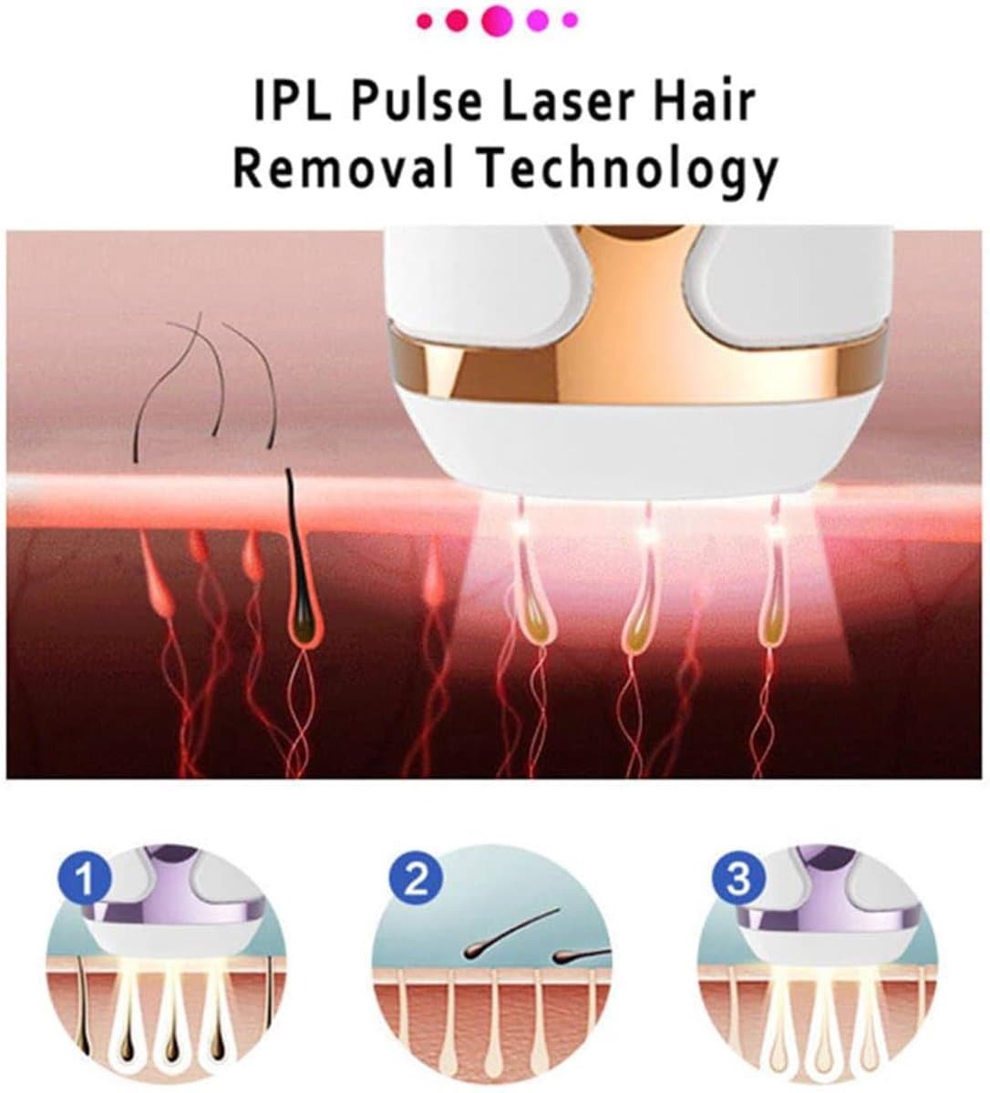 IPL Laser Ontharing Apparaat Permanente Pijnloze Remover Vermindering van Haargroei voor Vrouwen en Man Thuis Hele Lichaam Oksels Rug Benen Armen Gezicht Bikini Lijn, Met koord thumbnail 5