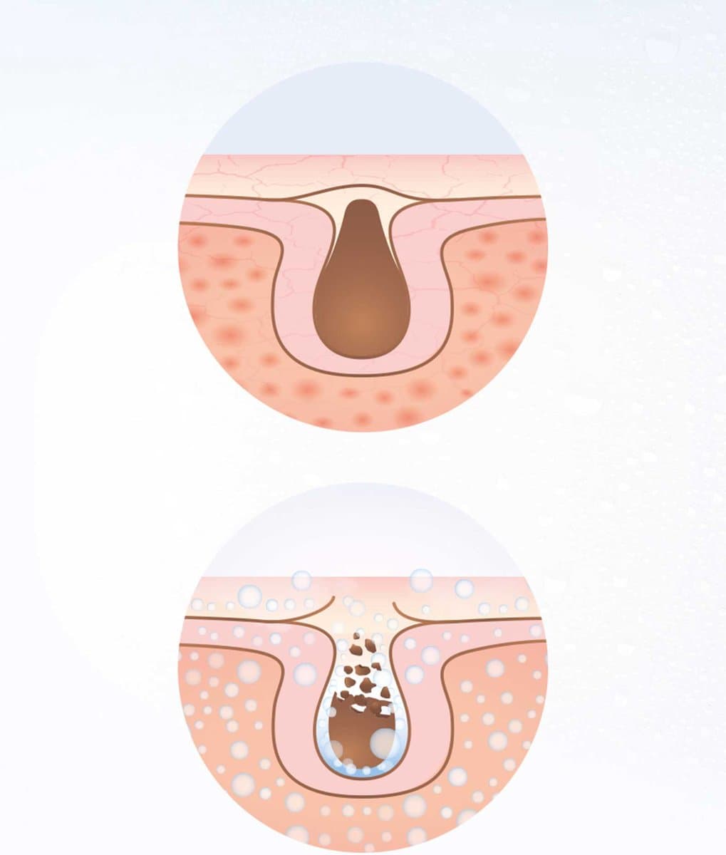 Lanaform - Facial Care - Facial Steamer - Gezichtssauna - Gezichtsreiniger - Inhalator - Gezichtsstomer - Poriënreiniger thumbnail 4