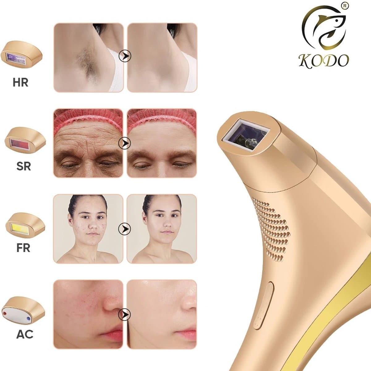 HFL Goods IPL Laserontharing - Epilator - Permanente Ontharing - Huidverbetering - Sterilisatie Bij Acne - Gekoelde Kop - Icy Feeling - Goudkleurig thumbnail 3