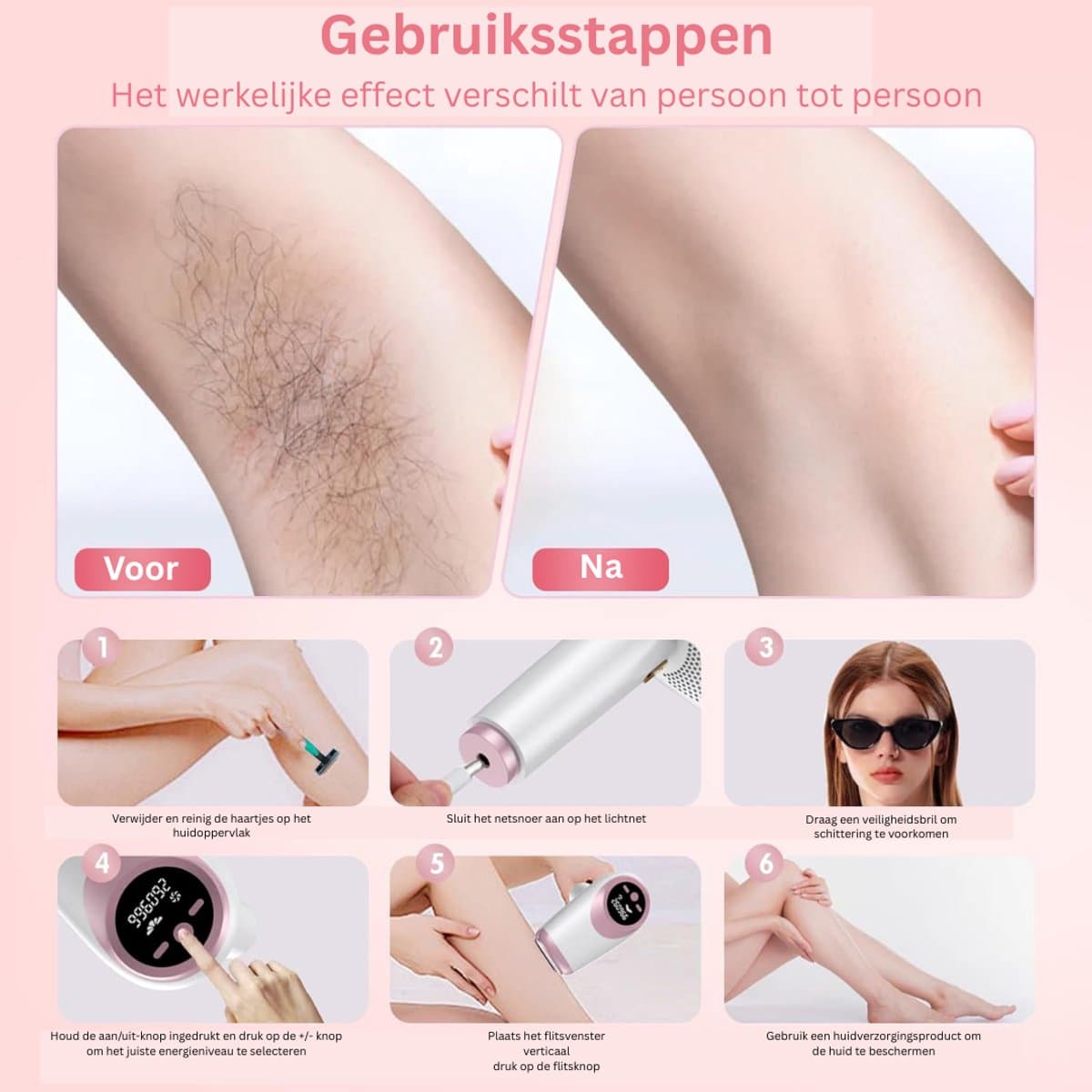 MKSS® Laser Ontharingsapparaat - IPL Ontharing - Mannen & Vrouwen - Wit en Roze thumbnail 7