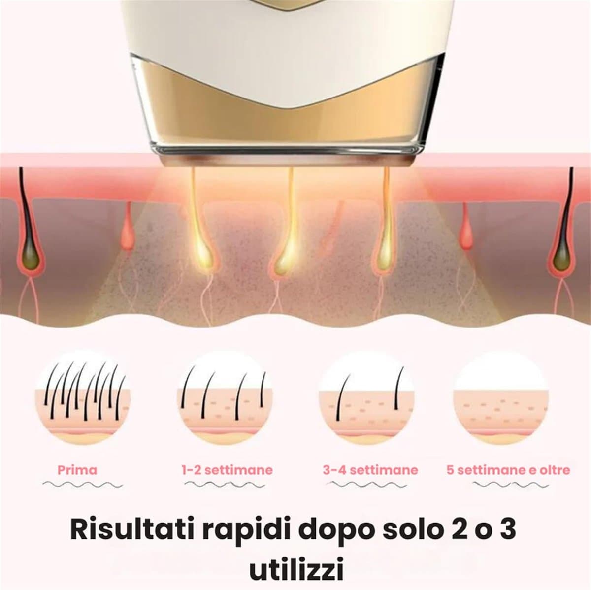 Epilator met gepulseerd licht, 2.0 epilator, IPL 2 in 1, epilator, IPL, laser ontharing voor vrouwen, mannen, gezicht, bikini, lichaam thumbnail 5