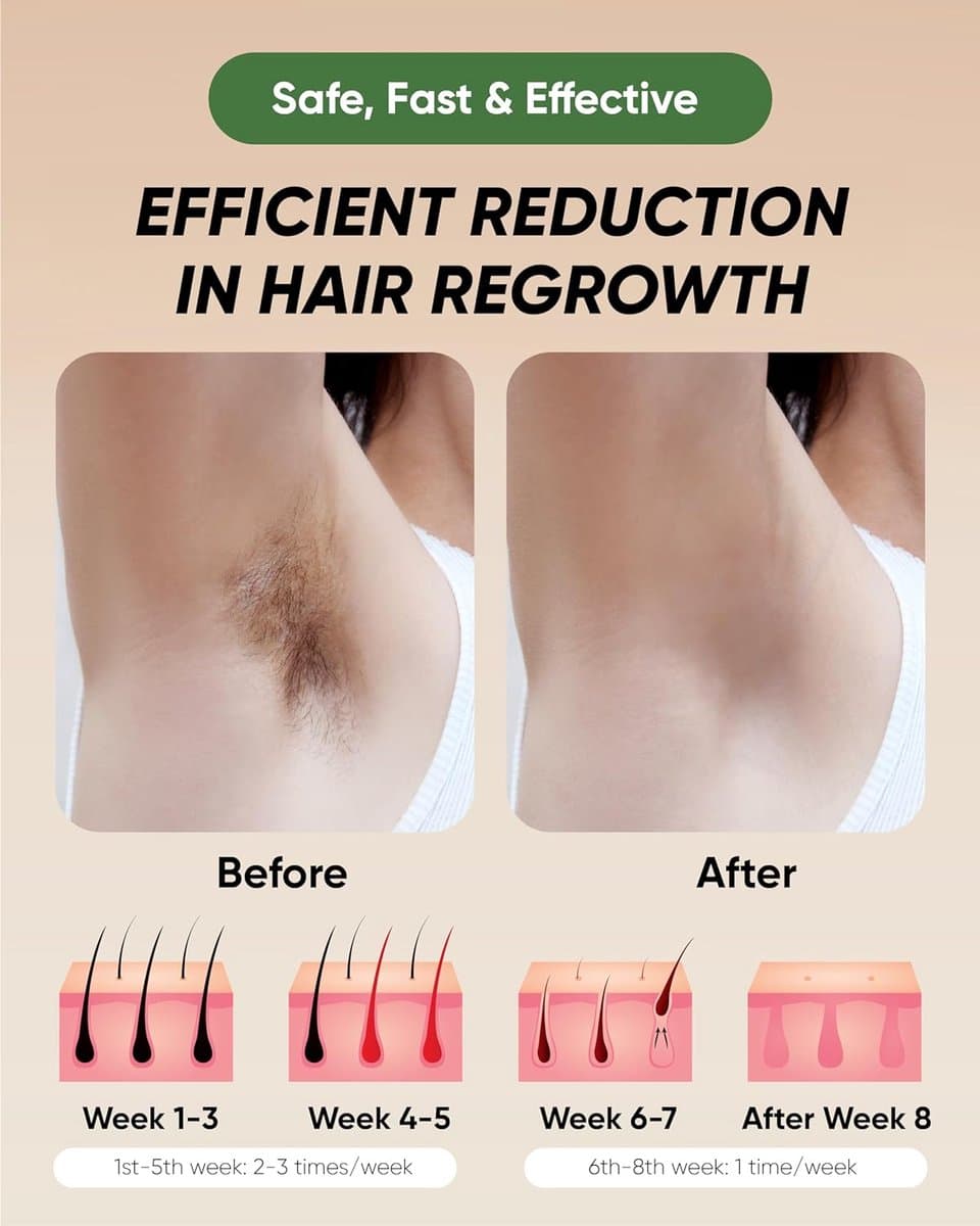Beauty Kit Epilator Dames Ontharing \ Laserontharing \ ipl laser hair removal thumbnail 6