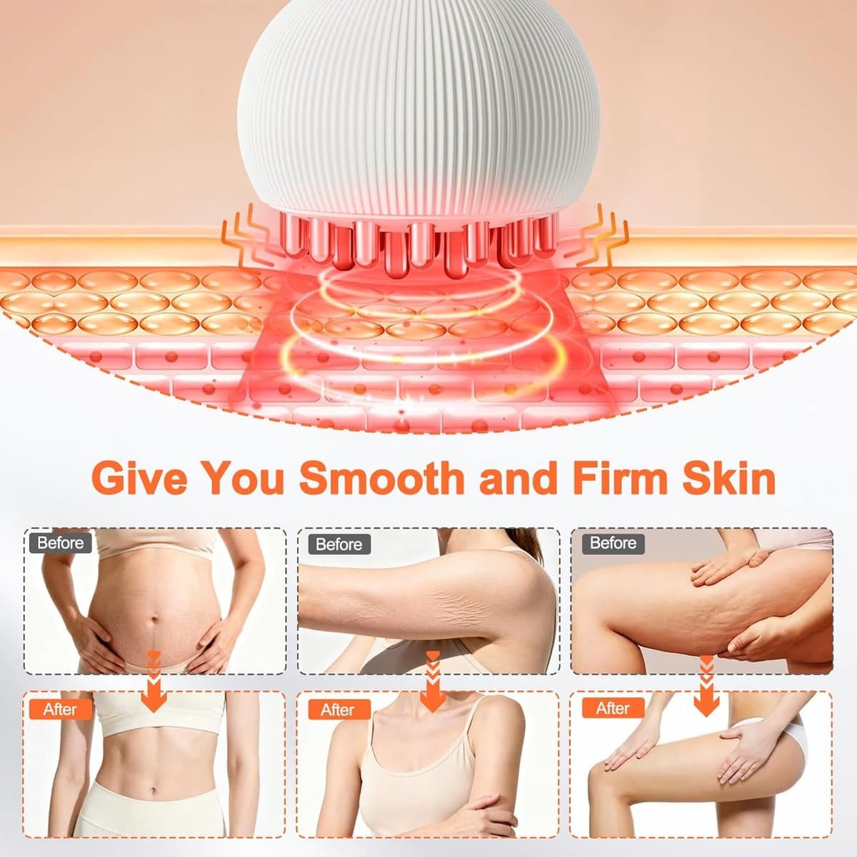 lymfedrainage apparaat-cellulite massage apparaat-massage- Verwijdert cellulitis en striae met microstroom, warmte en licht - Voor slanke benen, buik & armen - Professioneel body sculpting apparaat- Wit thumbnail 2