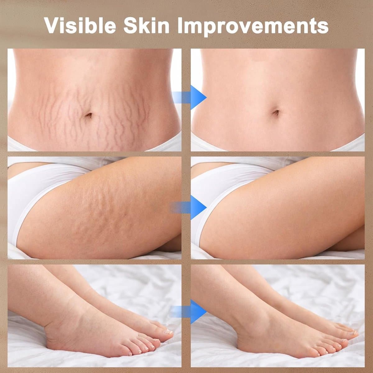 lymfedrainage apparaat-cellulite massage apparaat-massage- Verwijdert cellulitis en striae met microstroom, warmte en licht - Voor slanke benen, buik & armen - Professioneel body sculpting apparaat- Wit thumbnail 3