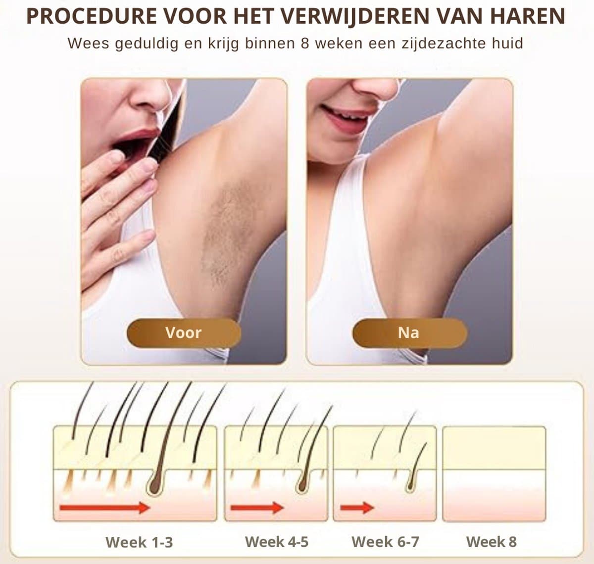 IPL Laser Ontharingsapparaat - Laser Ontharing Met IJskoeling - Ontharing Laser - Ontharingsapparaat Laser - Ontharingsapparaten Laser - Ontharingsapparaat Voor Vrouwen En Mannen - Voor Gezicht En Lichaam - 3 in 1 Functies thumbnail 6